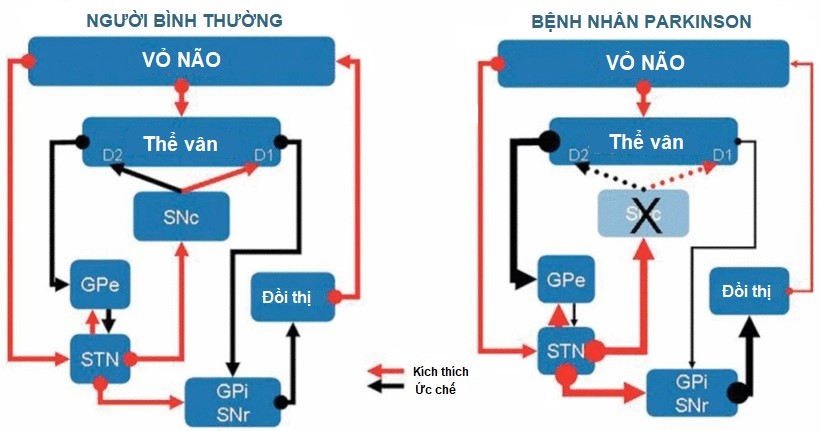 Vai trò của hạch nền trong kiểm soát vận động ở người bình thường và bệnh nhân Parkinson