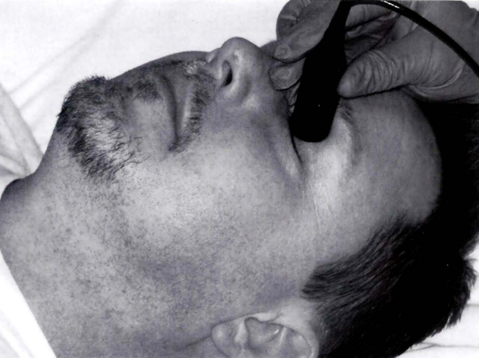 Siêu âm Doppler xuyên sọ: từ lý thuyết đến thực hành