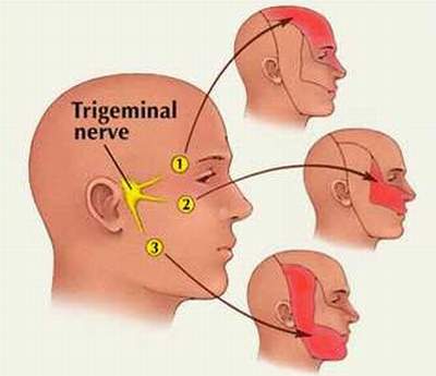 Những thách thức trong đau thần kinh