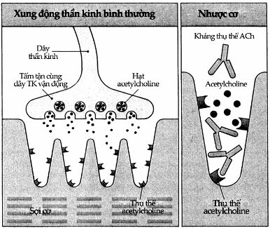 Đánh giá nồng độ tự kháng thể kháng thụ cảm thể acetylcholine ở bệnh  nhân nhược cơ