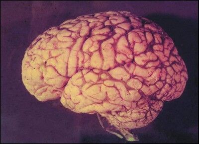 Quan điểm mới: Hoạt tính tự vệ nội sinh, Tính mềm dẻo, Sự tái tạo thần kinh và lý luận trị liệu trong bệnh lý thần kinh
