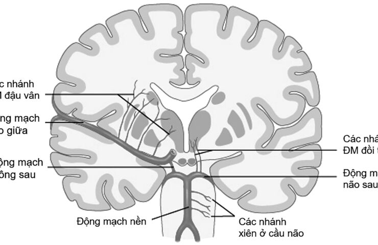 Hội chứng ổ khuyết