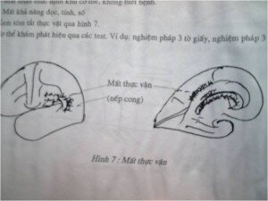THẦN KINH TÂM LÝ LÂM SÀNG