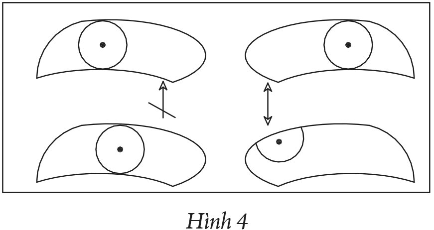 Liệt chức năng nhìn