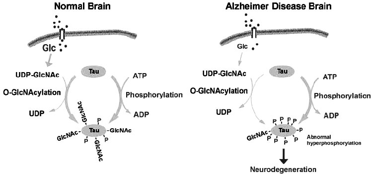 Hóa sinh của  bệnh Alzheimer Biochemistry of Alzheimer's disease