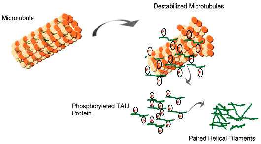 Hóa sinh của  bệnh Alzheimer Biochemistry of Alzheimer's disease