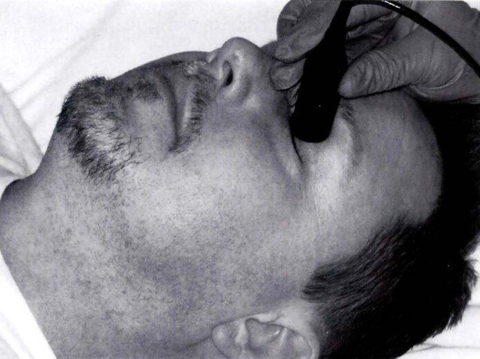 Siêu âm Doppler xuyên sọ: từ lý thuyết đến thực hành