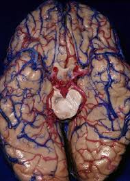 Các rối loạn Thần kinh thực vật trong bệnh teo da hệ thống thể tiểu não