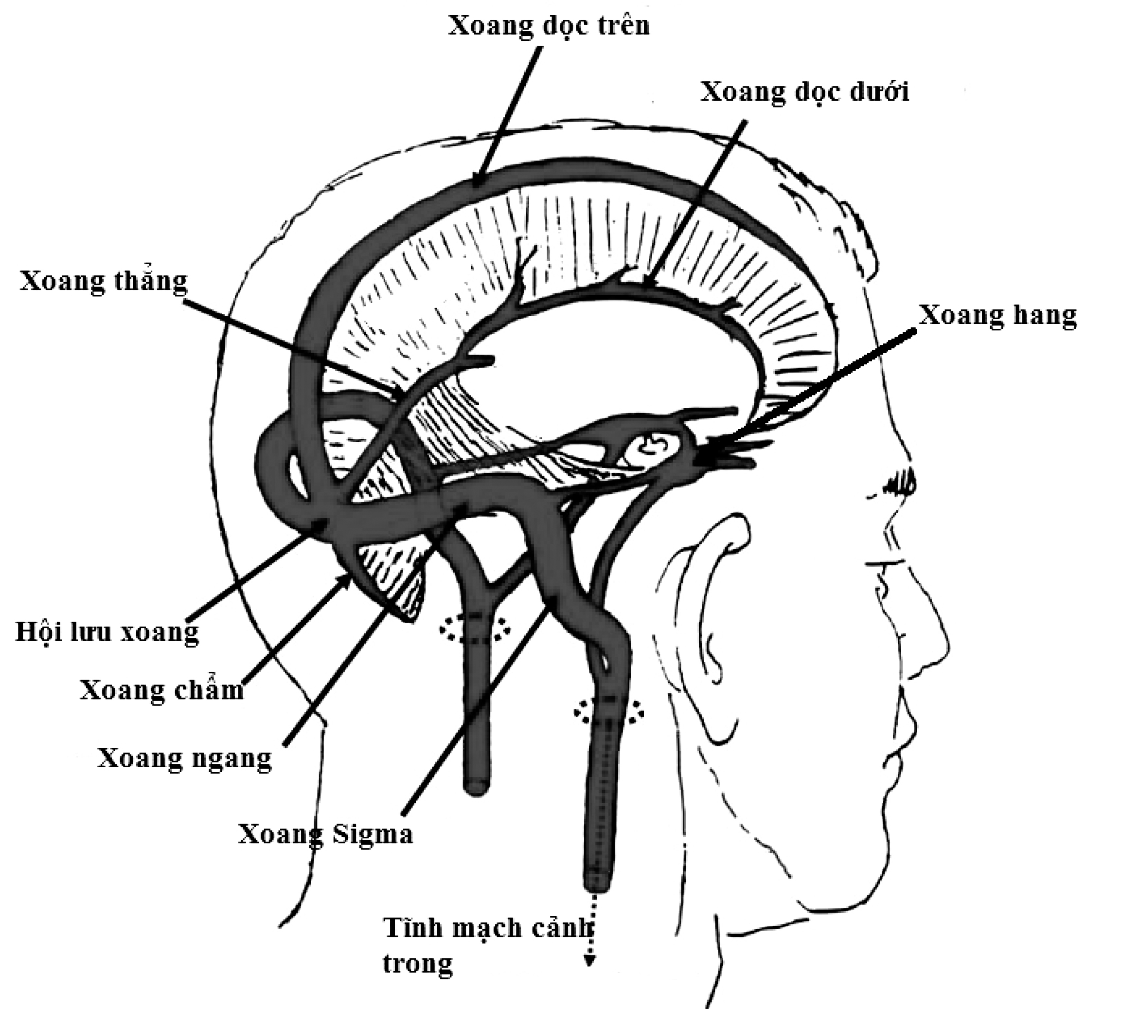 Hình ảnh cộng hưởng từ não mạch não trong huyết khối tĩnh mạch não
